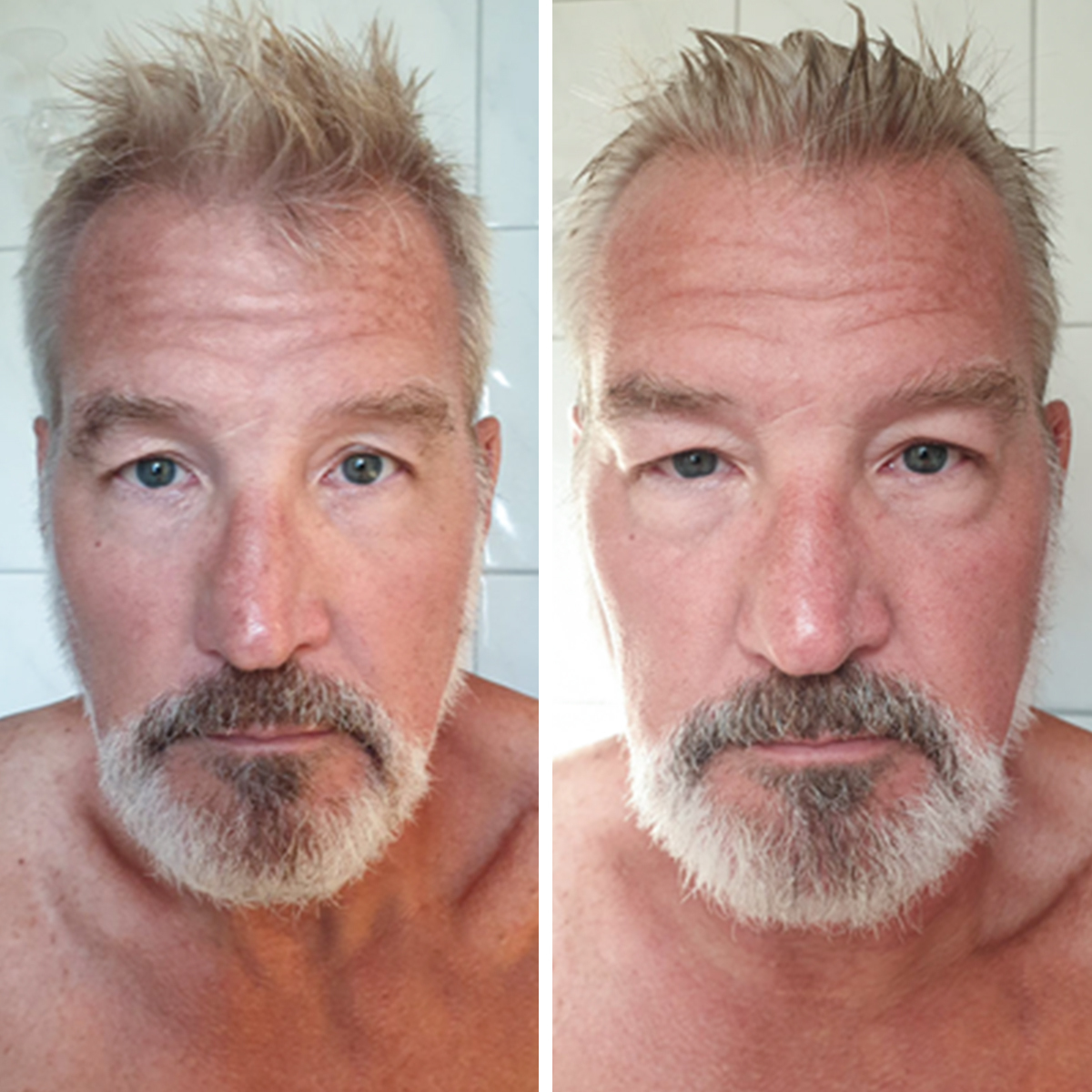 Particle Face Cream Before & After Jeremy Flipped