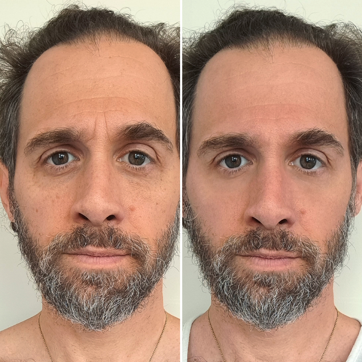 Particle Face Cream Jason Schaeffer Before & After