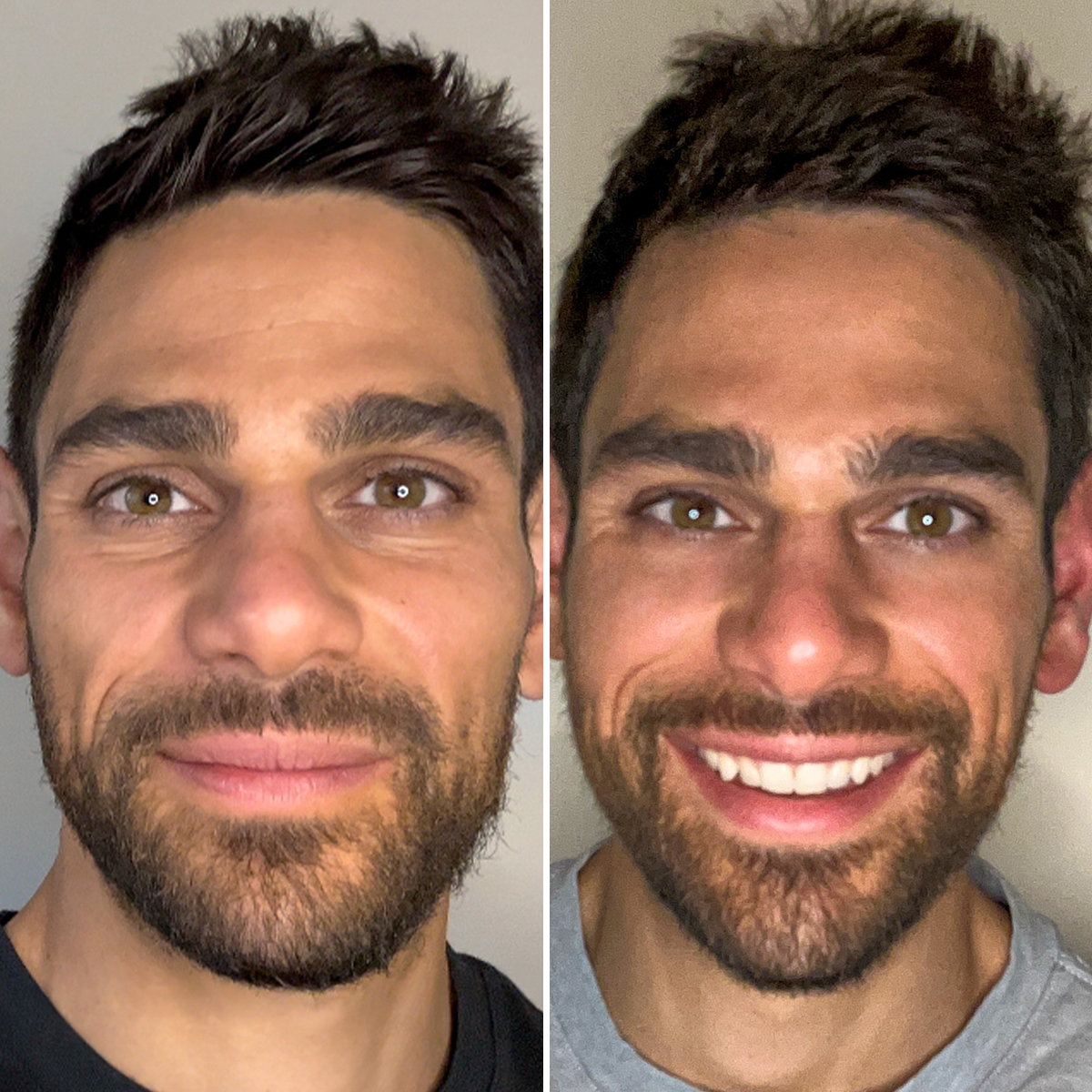 Particle Face Cream Kyle Axman Before & After