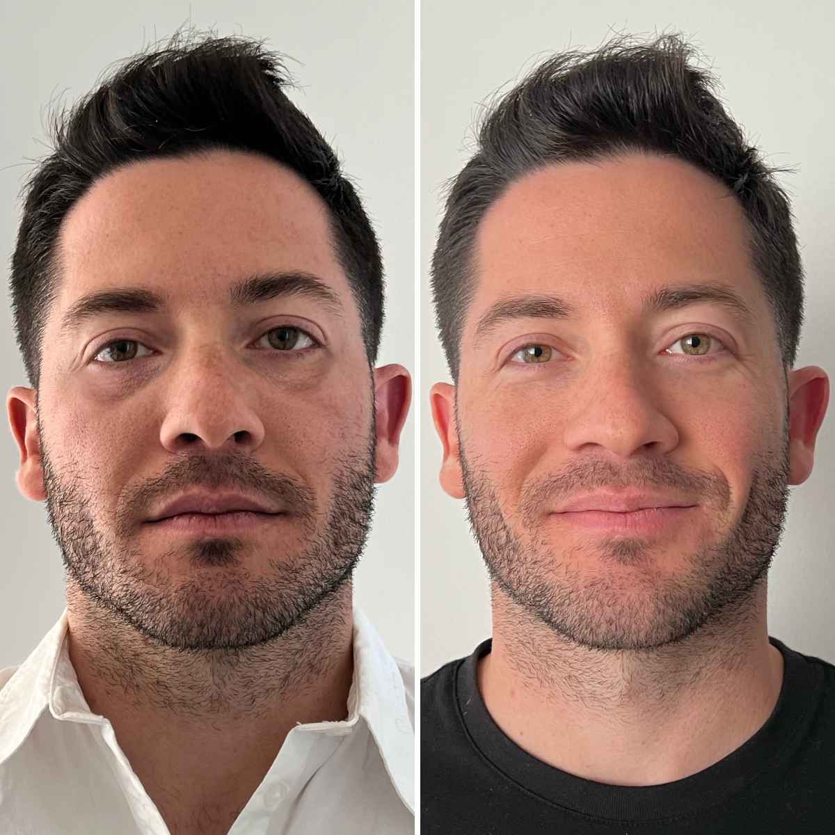 Particle Face Cream Brayden Bernstein Before & After